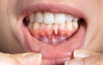 Dental Consultation