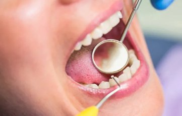 Dental Consultation