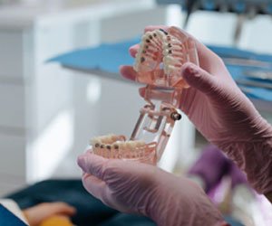 Orthodontic Treatments